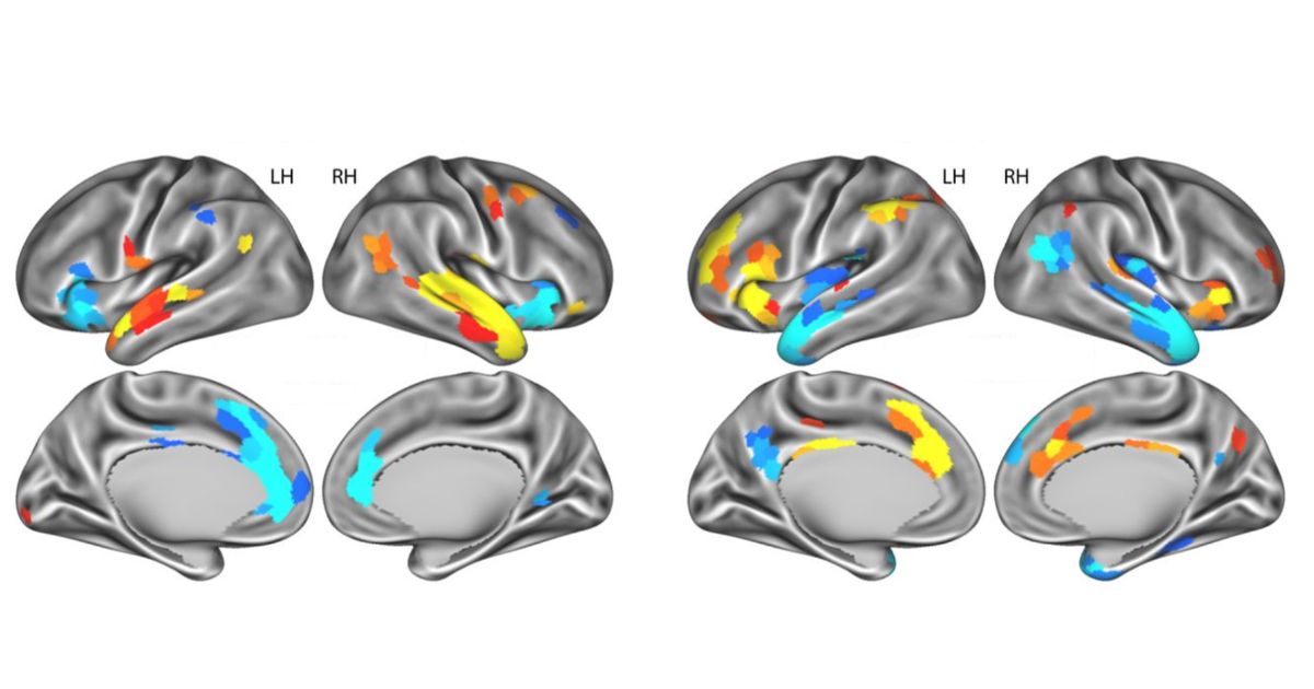 Brain activity map from a psychology study