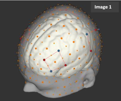 SAND project - graphic of brain data on neurocognitive development