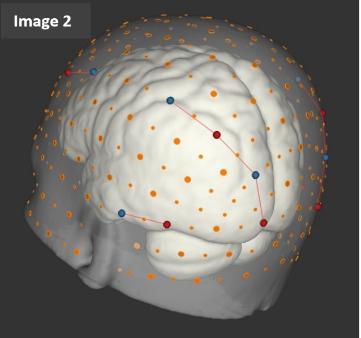 SAND project - graphic of brain data on neurocognitive development